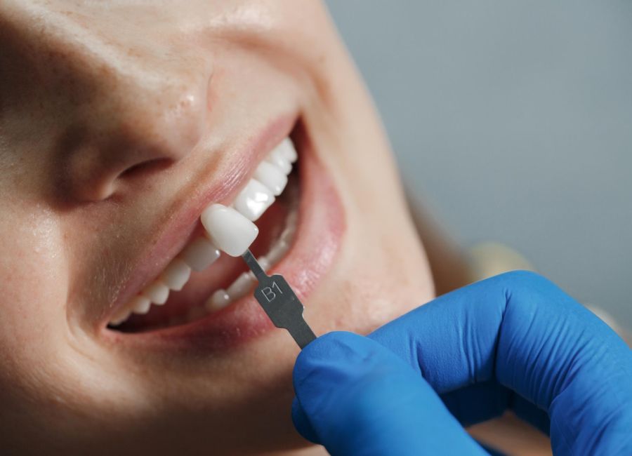 Zirkonyum Restorasyonlar