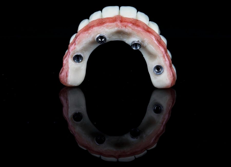 İmplant Üstü Protezler